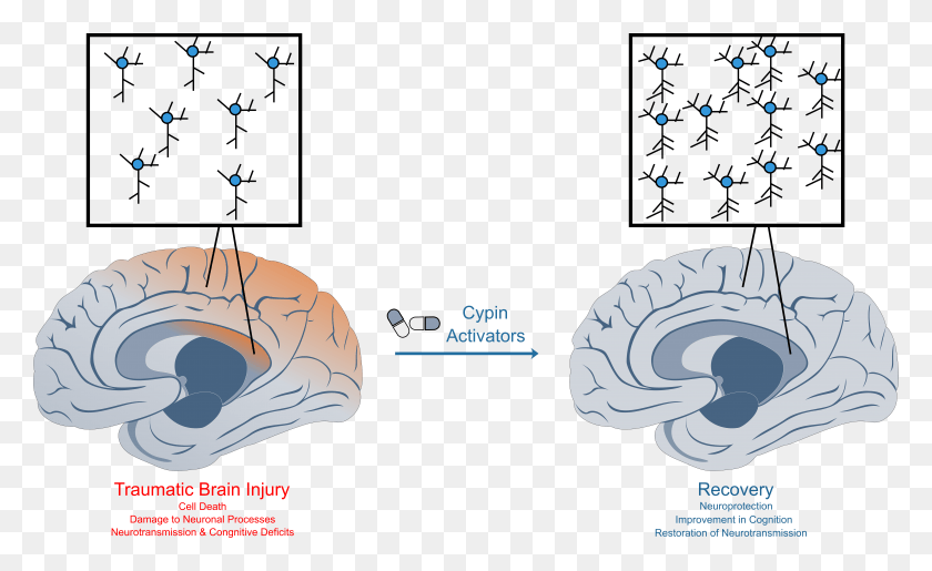 8429x4917 Traumatic Brain Injury Causes Widespread Damage To Traumatic Brain Injury, Plant, Tree, Nature HD PNG Download