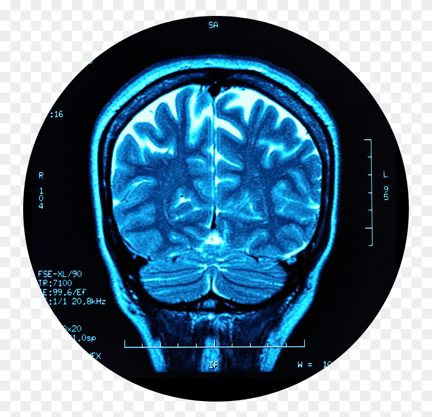751x751 Травматическая Травма Головного Мозга Электронейродиагностический Технолог, Рентген, Компьютерная Томография, Рентгеновская Пленка Для Медицинской Визуализации Hd Png Скачать