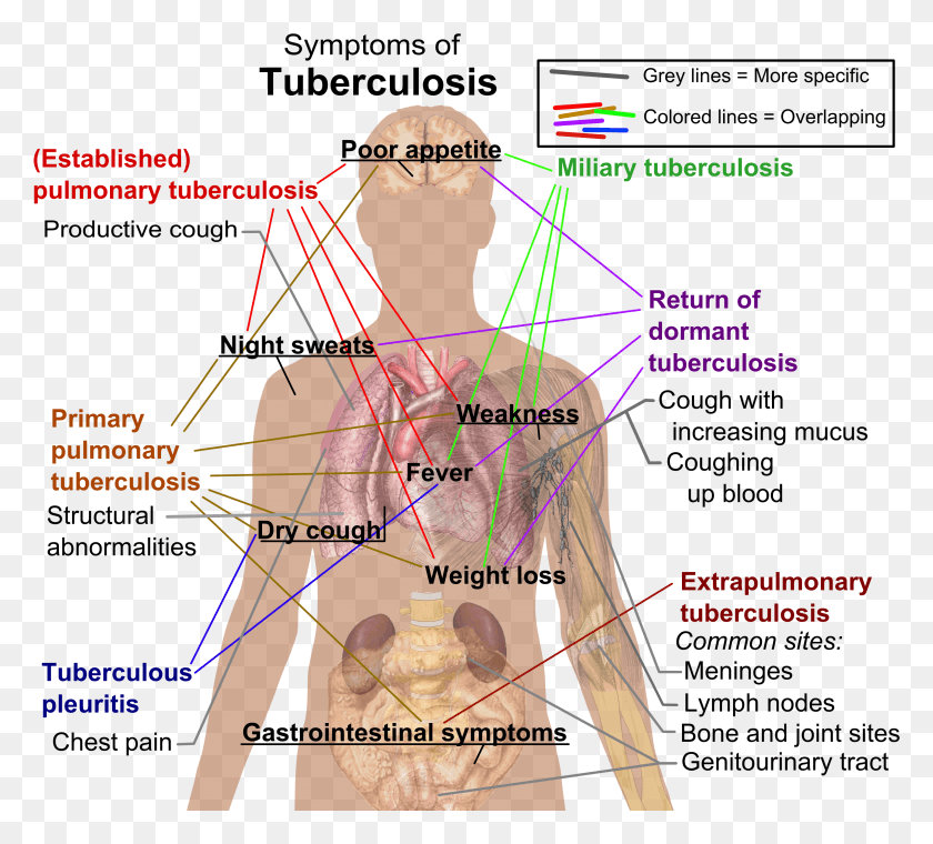 3052x2739 Симптомы Туберкулеза Органная Система Туберкулеза, График, Диаграмма, Человек Hd Png Скачать