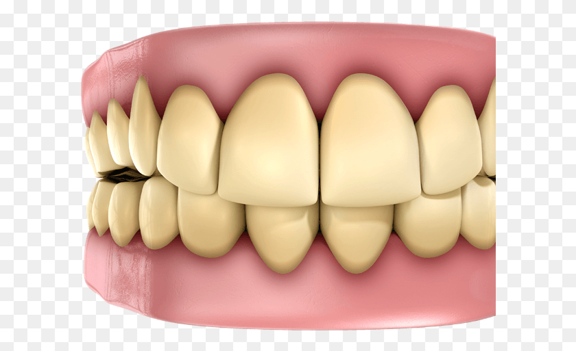 Types Of Dental Stains Coffee Stains On Dentures, Teeth, Mouth, Lip HD PNG Download