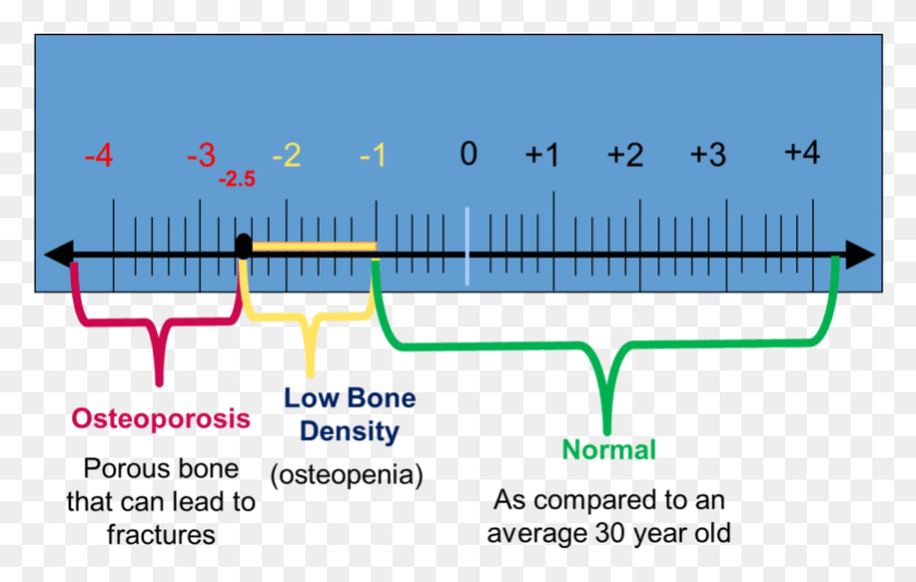 781x475 Understanding Bone Density Results Scale Of Osteoporosis, Plot, Bird, Animal HD PNG Download