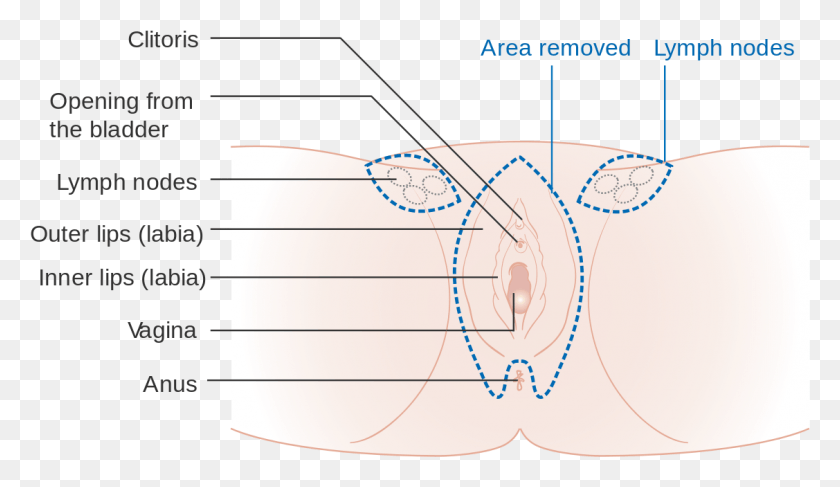 1127x617 Vulva Area, Plot, Outdoors, Nature HD PNG Download