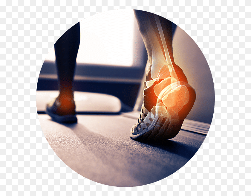 598x598 What Conditions Can Shockwave Therapy Treat Orthopaedic Physiotherapy, Clothing, Apparel, Shoe HD PNG Download