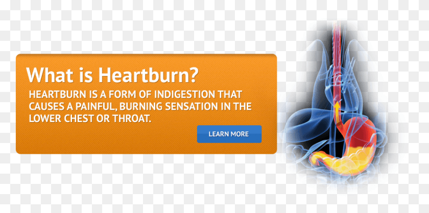 857x393 What Is Heartburn Cancer De Colon, Text, Business Card, Paper HD PNG Download