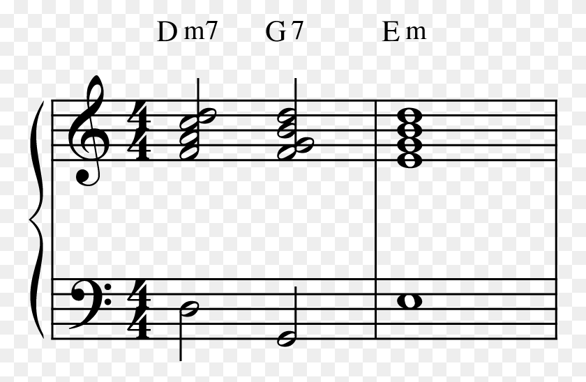 758x488 When Chords Misbehave Chord Resolution, Gray, World Of Warcraft HD PNG Download