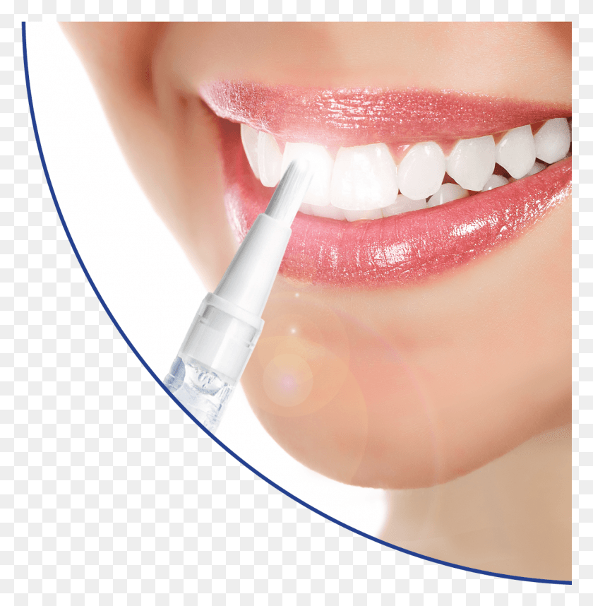 1201x1229 White Blitz Teeth Whitening Teeth Whitening For Spassalons Lifetime Teeth Whitening, Mouth, Lip HD PNG Download