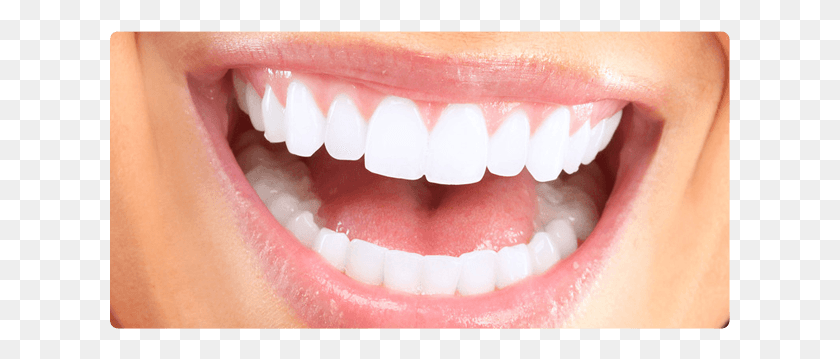 621x299 White Teeth Straight Teeth Smile, Mouth, Lip, Person HD PNG Download